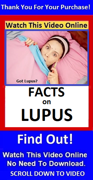 Video On Lupus Facts
